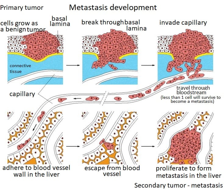 Metastatis formation