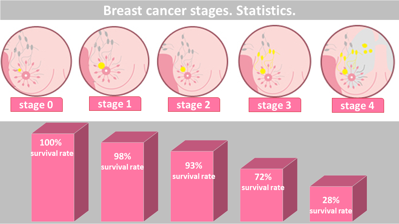 Breast cancer stages. Success rate for each stage.