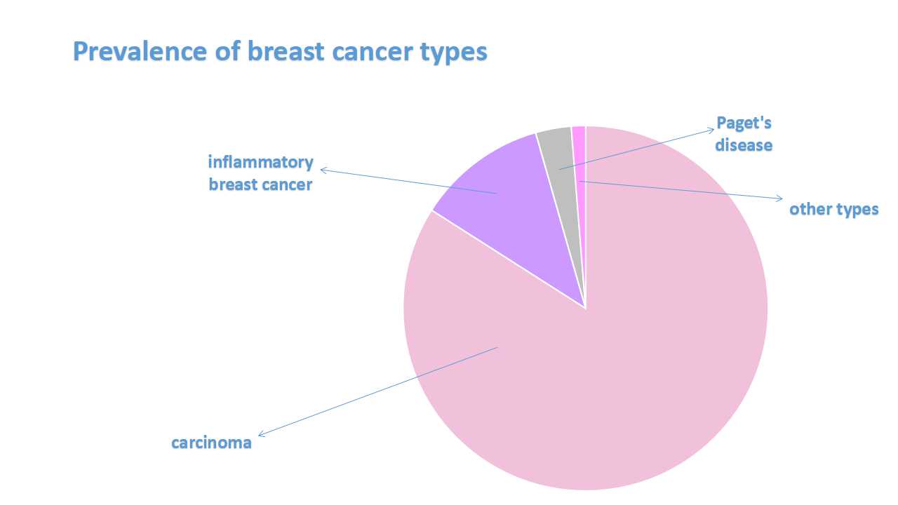 Breast cancer types (diagram)